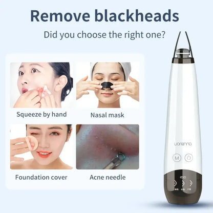 Novelto™ Blackhead Remover Vacuum